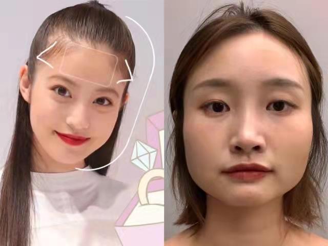 不要选择露额头和发际线的造型 不要选择露额头和发际线的造型